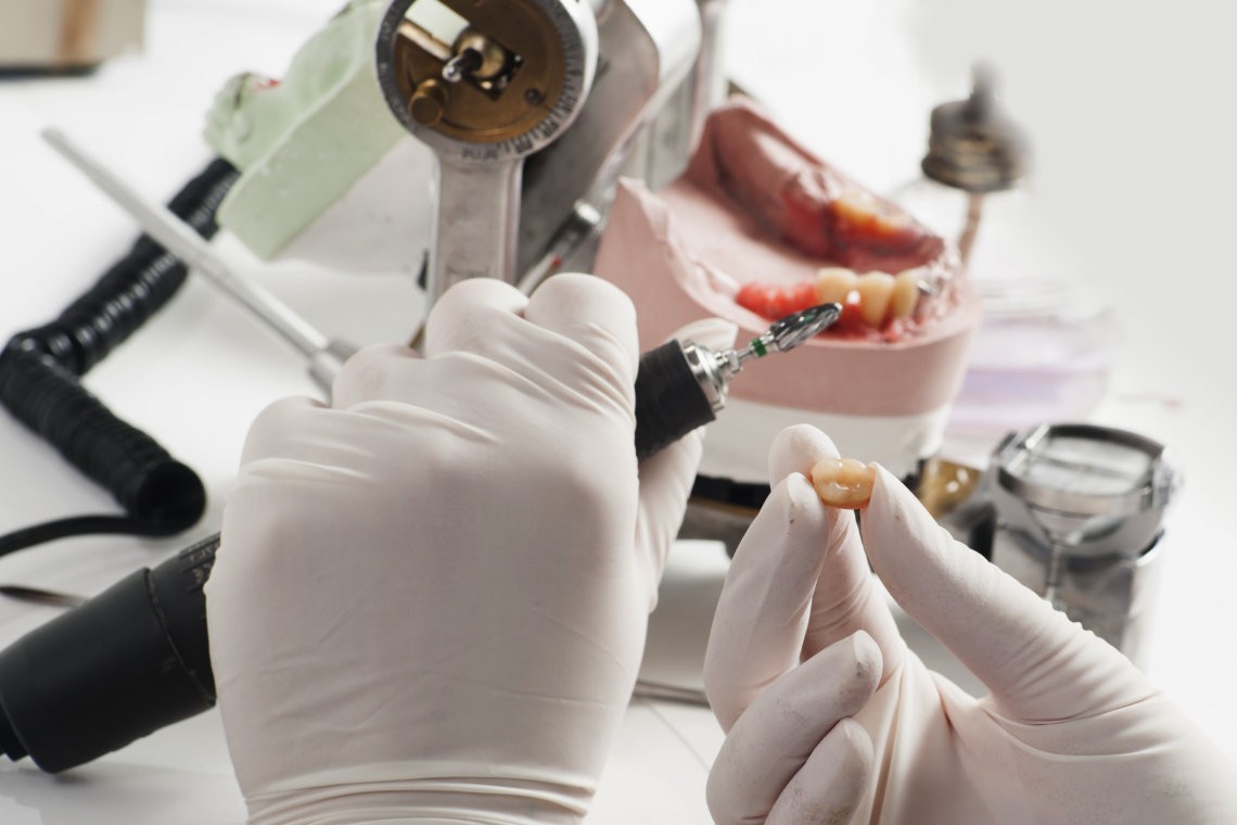 ODs Dental Laboratory- Tustin, CA